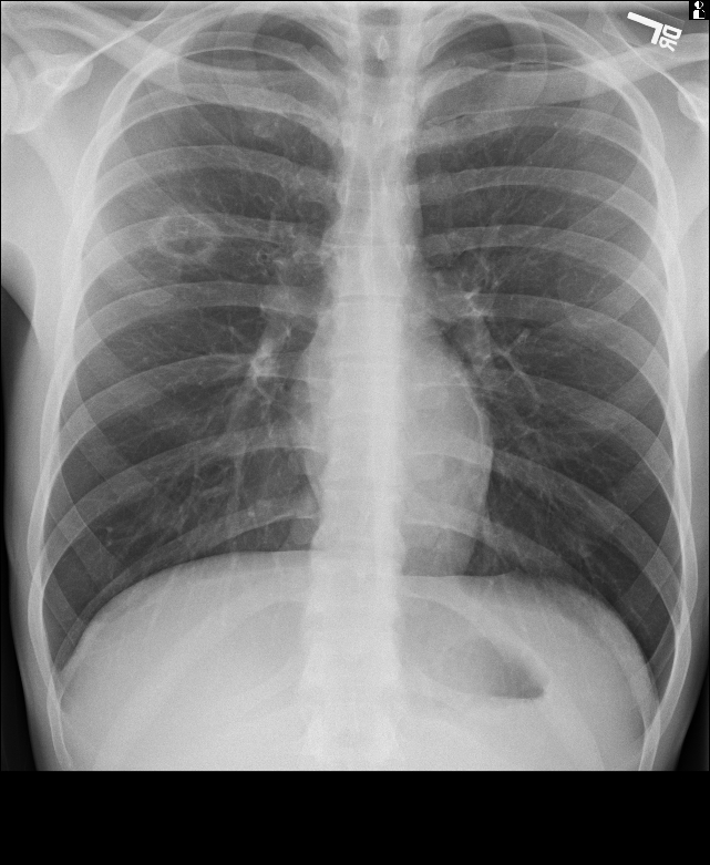 digital-radiography-x-ray-river-radiology